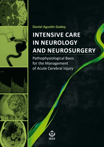 Intensive Care In Neurology And Neurosurgery Pathophysiological Basis For The Management Of Acute Cerebral Injury Daniel Agustin Godoy