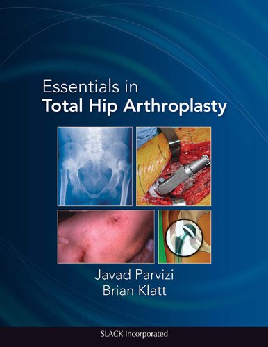 Essentials In Total Hip Arthroplasty 1st Edition Javad Parvizi Md
