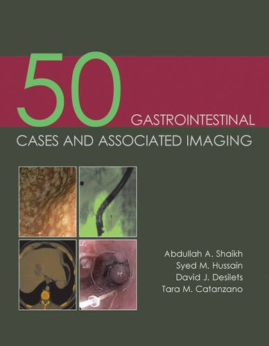 50 Gastrointestinal Cases And Associated Imaging 1st Edition Abdullah A Shaikh