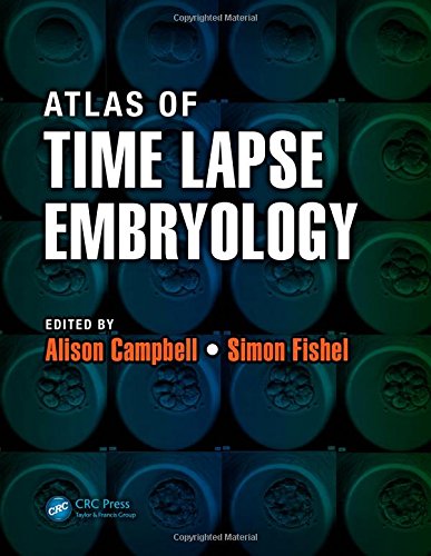 Atlas Of Time Lapse Embryology 1st Edition Alison Campbell Simon Fishel
