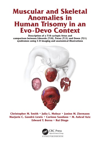 Muscular And Skeletal Anomalies In Human Trisomy In An Evodevo Context Description Of A T18 Cyclopic Fetus And Comparison Between Edwards T18 Patau T13 And Down T21 Syndromes Using 3d Imaging And Anatomical Illustrations Rui Diogo