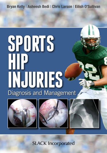 Sports Hip Injuries Diagnosis And Management 1st Edition Bryan Kelly Md