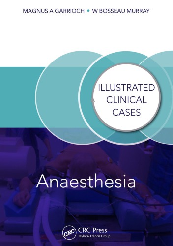 Anaesthesia Garrioch Magnus