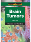 Brain Tumors Peggy Parks