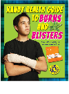 Handy Health Guide To Burns And Blisters Alvin Silverstein Virginia Silverstein