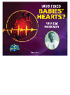 Who Fixed Babies Hearts Vivien Thomas Sara L Latta
