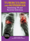 Tuberculosis And Superbugs Examining Tb And Bacterial Infections Evelyn B Kelly
