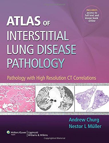 Atlas Of Interstitial Lung Disease Pathology Pathology With High Resolution Ct Correlations 1st Edition Andrew Churg Md