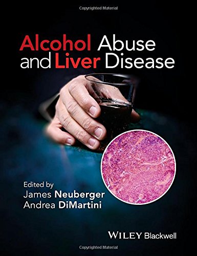 Alcohol Abuse And Liver Disease 1st Edition Andrea Dimartini