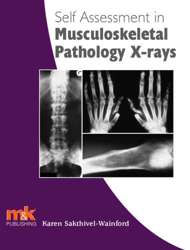 Selfassessment In Axial Skeleton Musculoskeletal Trauma Xrays Sakthivelwainford