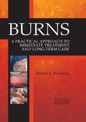Burns A Practical Approach To Immediate Treatment And Long Term Care Sheridan