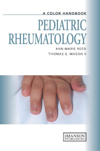 Pediatric Rheumatology A Color Handbook Reed Anne Marie Mason