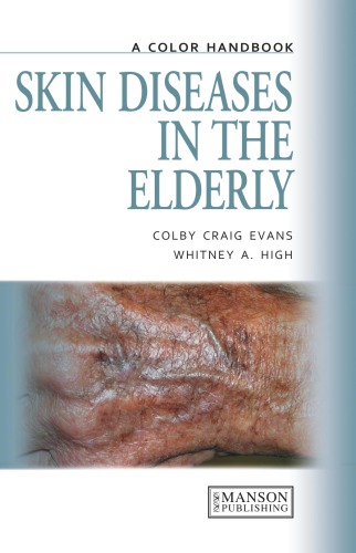 Skin Diseases In The Elderly A Color Handbook Evans Colby Craig High
