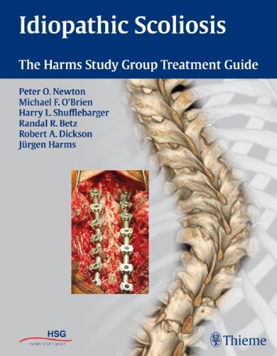 Idiopathic Scoliosis The Harms Study Group Treatment Guide 1st Edition Peter O Newton