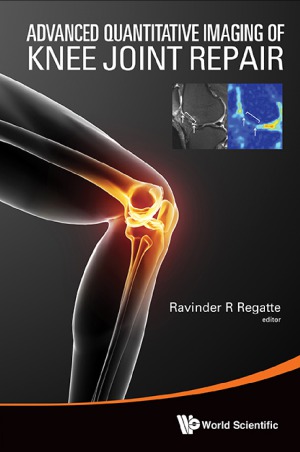 Advanced Quantitative Imaging Of Knee Joint Repair Ravinder R Regatte