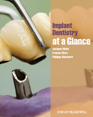 Implant Dentistry Ataglance Jacques Malet Francis Mora Philippe Bouchard