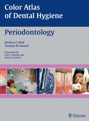 Color Atlas Of Dental Hygiene Periodontology Herbert F Wolf