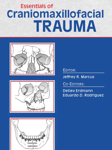 Essentials Of Craniomaxillofacial Trauma Erdmann Md Detlev Marcus