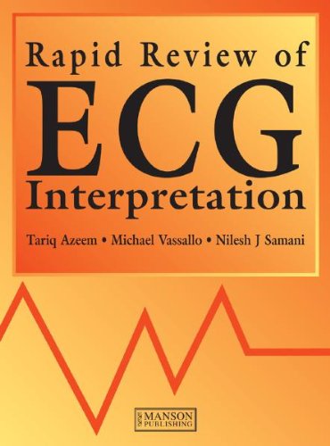 Rapid Review Of Ecg Interpretation Azeem Tariq Samani Nilesh J Vassallo