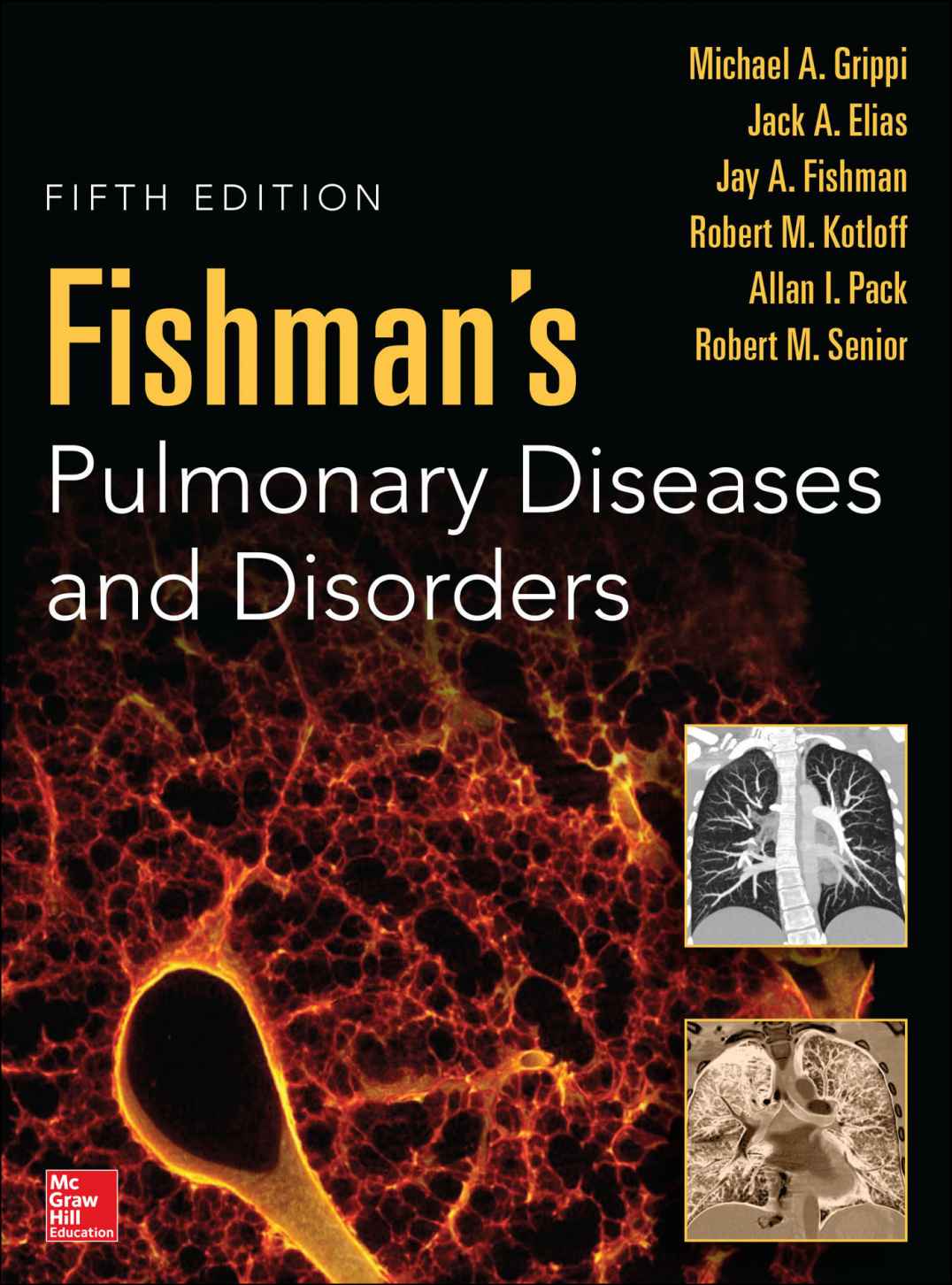 Fishmans Pulmonary Diseases And Disorders Fifth Edition 5th Edition Grippi