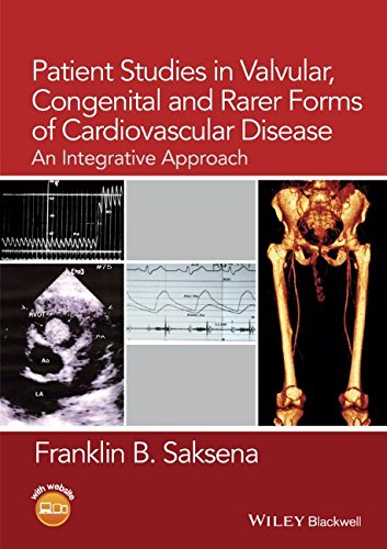 Patient Studies In Valvular Congenital And Rarer Forms Of Cardiovascular Disease An Integrative Approach 1st Edition Franklin B Saksena