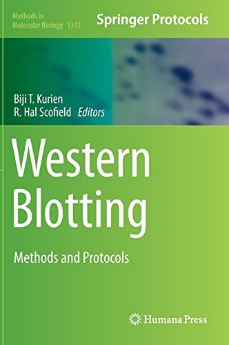 Western Blotting Methods And Protocols Biji T Kurien R Hal Scofield