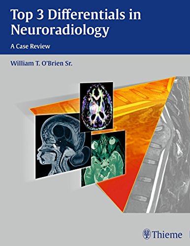 Top 3 Differentials In Neuroradiology 1st Edition William T Obrien