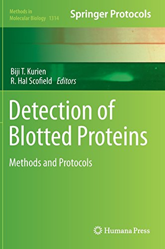 Detection Of Blotted Proteins Methods And Protocols Biji T Kurien