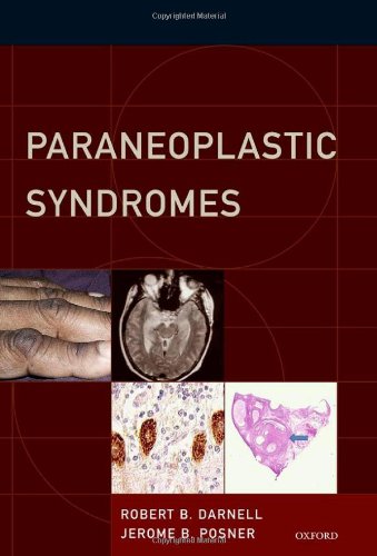 Paraneoplastic Syndromes 1st Edition Robert B Darnell Jerome B Posner