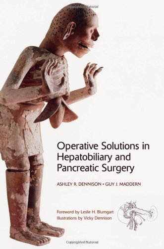 Operative Solutions In Hepatobiliary And Pancreatic Surgery 1st Edition Guy Maddern
