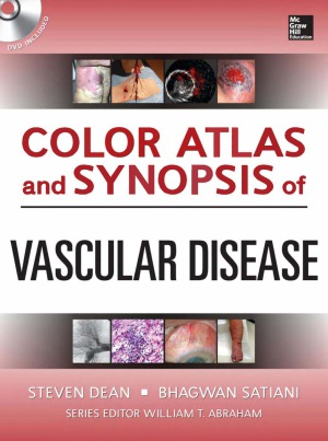 Color Atlas And Synopsis Of Vascular Disease Steven Dean Bhagwan Satiani