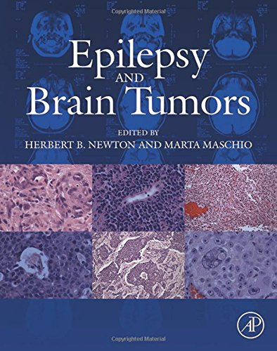 Epilepsy And Brain Tumors 1st Edition Herbert B Newton Marta Maschio