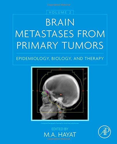 Brain Metastases From Primary Tumors Volume 2 Epidemiology Biology And Therapy 1st Edition M A Hayat