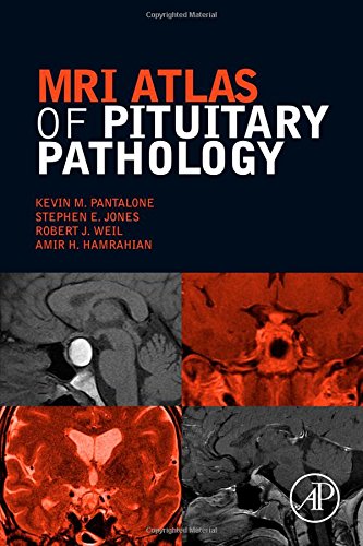 Mri Atlas Of Pituitary Pathology 1st Edition Kevin M Pantalone Do Ecnu Ccd