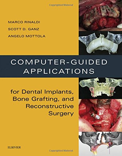 Computerguided Applications For Dental Implants Bone Grafting And Reconstructive Surgery 1 Harpsc Marco Rinaldi