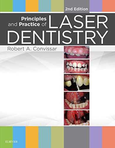Principles And Practice Of Laser Dentistry 2e 2nd Edition Robert A Convissar Dds Fagd