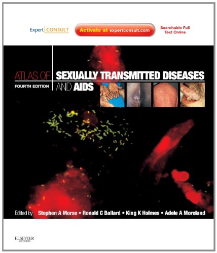 Atlas Of Sexually Transmitted Diseases And Aids Expert Consult 4e 4th Edition Stephen A Morse