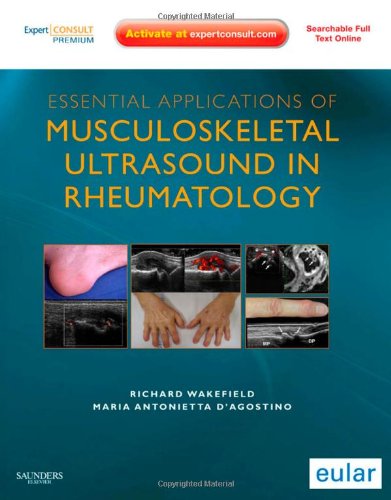 Essential Applications Of Musculoskeletal Ultrasound In Rheumatology Expert Consult Premium Edition Enhanced Online Features And Print 1e 1 Harpsc Richard J Wakefield
