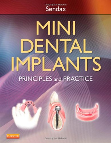 Mini Dental Implants Principles And Practice 1e 1st Edition Victor Dr Sendax