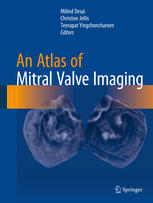 An Atlas of Mitral Valve Imaging 1st edition Milind Desai Christine Jellis