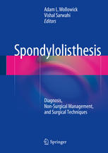 Spondylolisthesis Diagnosis Nonsurgical Management And Surgical Techniques 1st Edition Adam L Wollowick