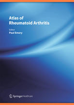 Atlas Of Rheumatoid Arthritis 1st Edition Paul Emery Eds