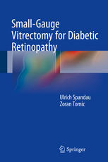 Smallgauge Vitrectomy For Diabetic Retinopathy 1st Edition Ulrich Spandau