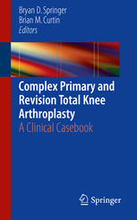 Complex Primary And Revision Total Knee Arthroplasty A Clinical Casebook 1st Edition Bryan D Springer