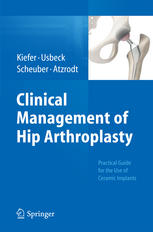 Clinical Management Of Hip Arthroplasty Practical Guide For The Use Of Ceramic Implants 1st Edition Hartmuth Kiefer Md