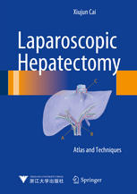 Laparoscopic Hepatectomy Atlas And Techniques 1st Edition Xiujun Cai Auth