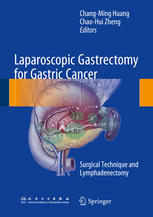 Laparoscopic Gastrectomy For Gastric Cancer Surgical Technique And Lymphadenectomy 1st Edition Changming Huang