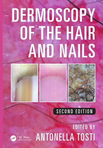 Dermoscopy Of The Hair And Nails Second Edition Tosti Antonella