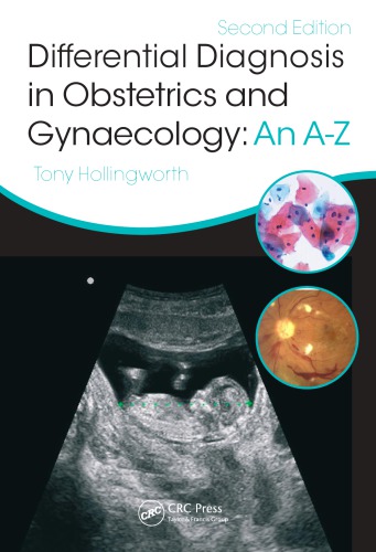 Differential Diagnosis In Obstetrics Gynaecology An Az Second Edition Hollingworth