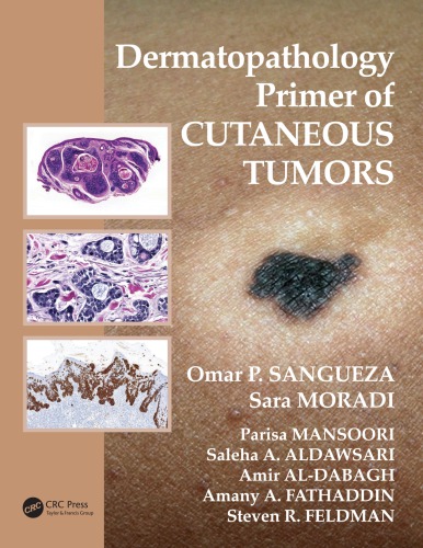 Dermatopathology Primer Of Cutaneous Tumors Sangeza Omar P